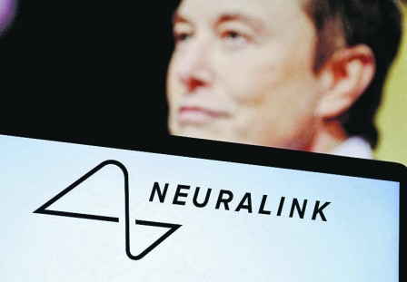 NeuralinkfHiNƹ